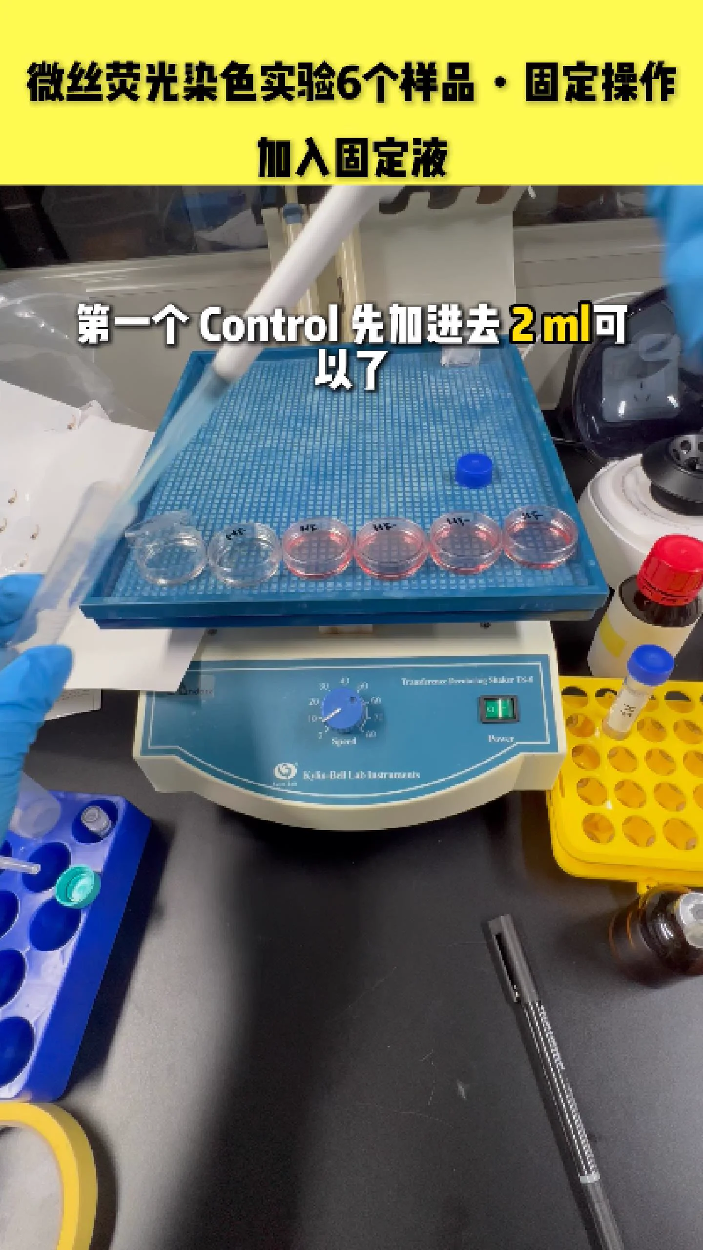 加固定液步骤 1