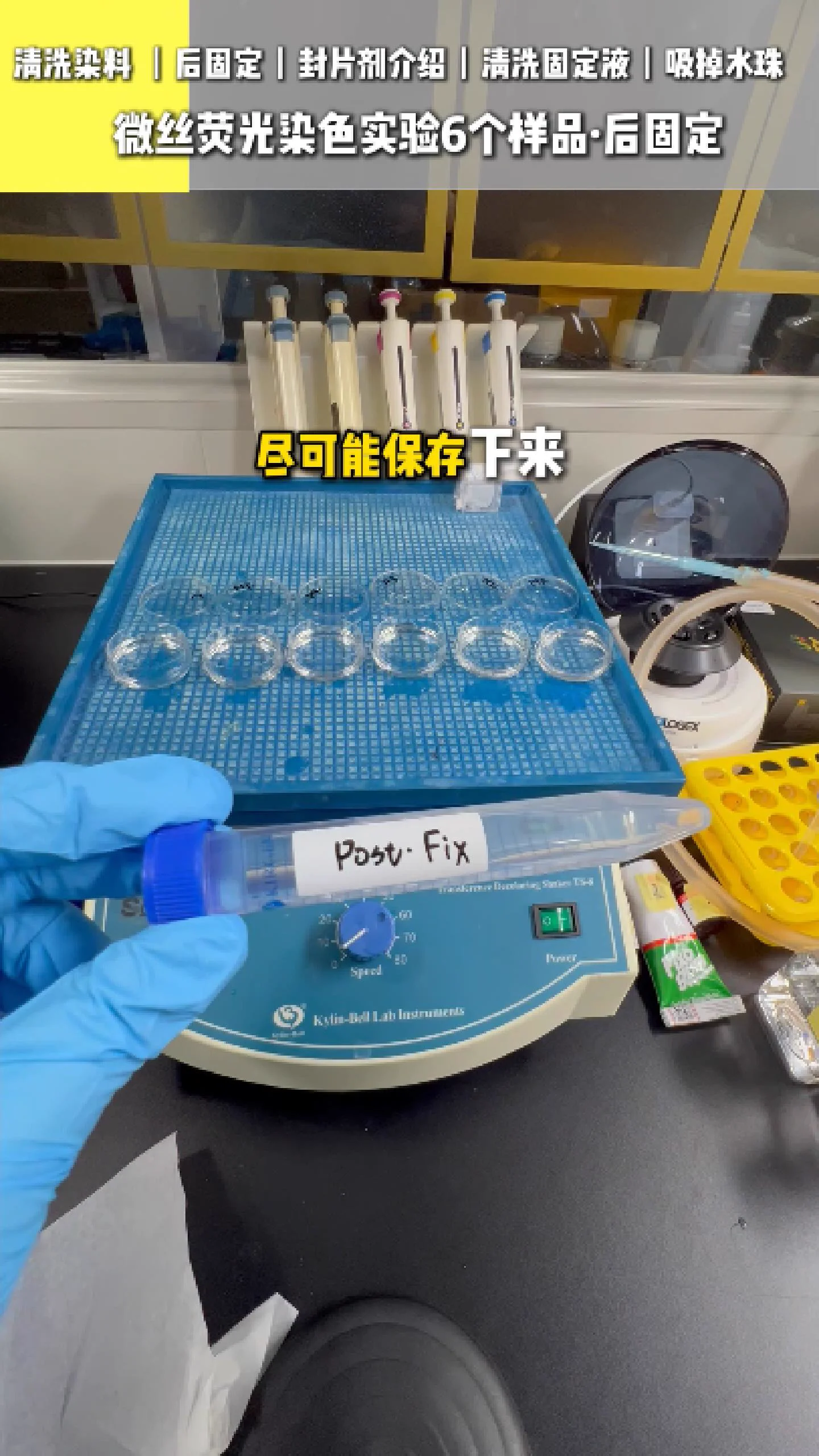 注入后固定液 1