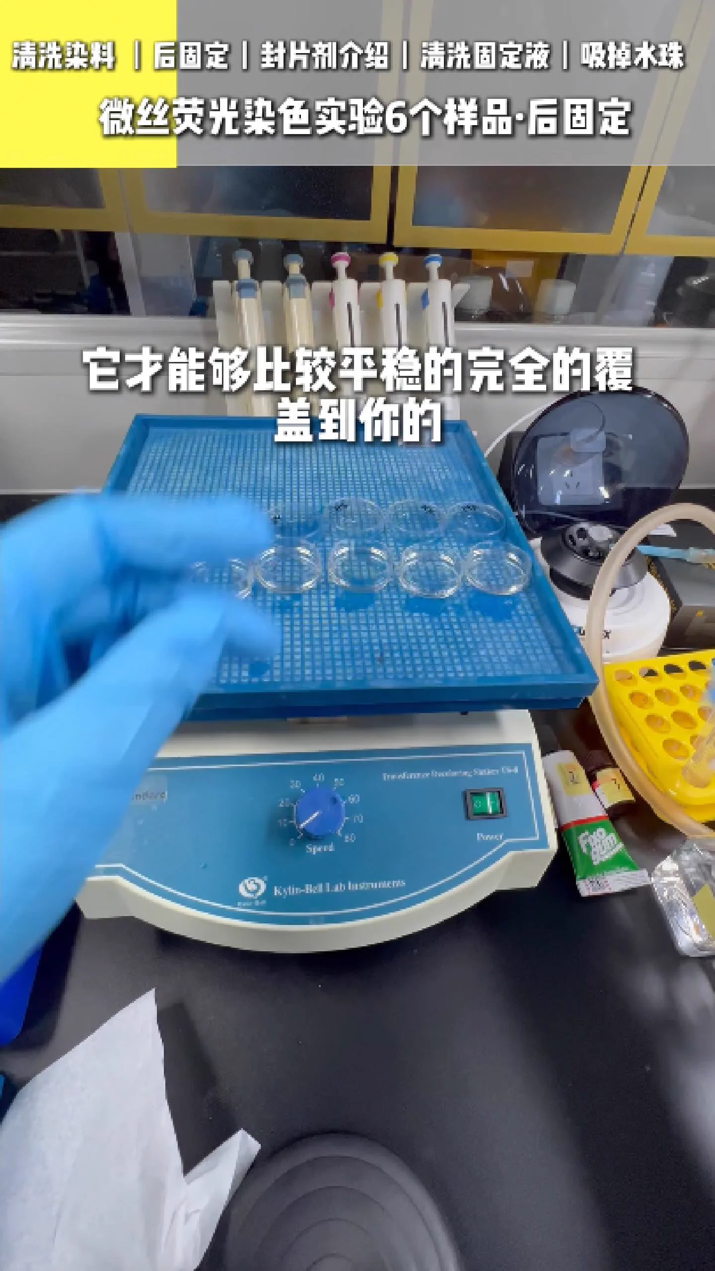 注入后固定液 2