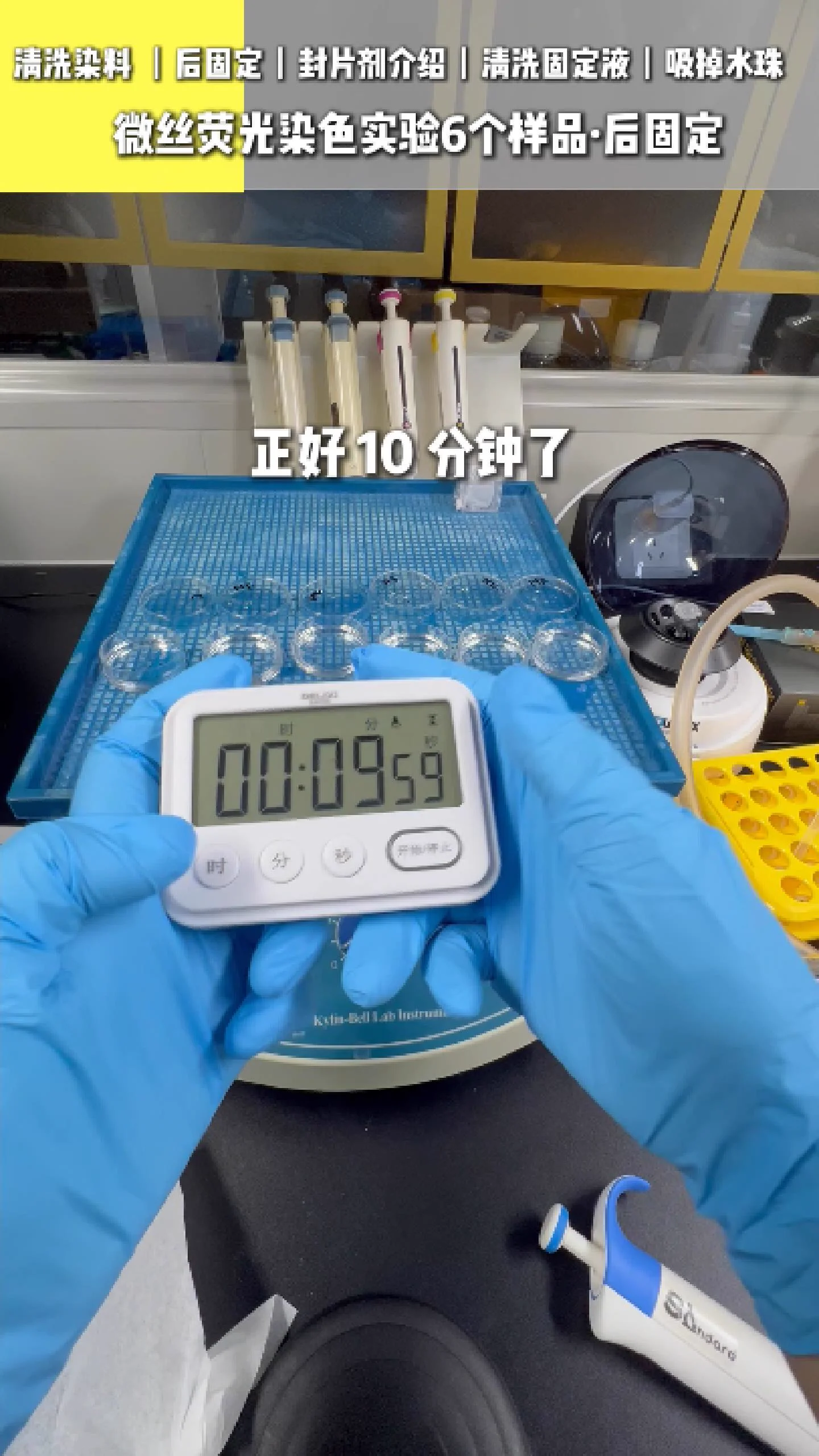 注入后固定液 3