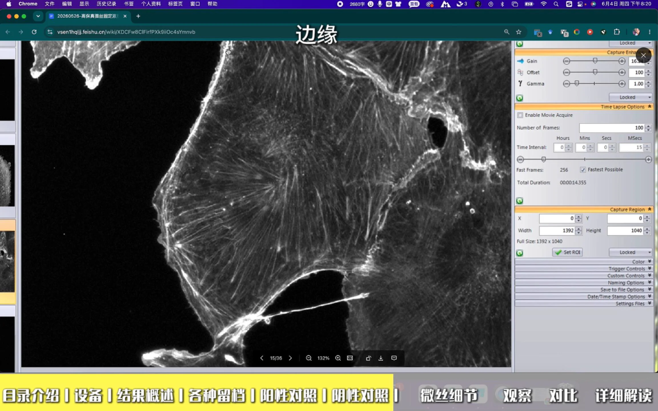 S01 普通固定液 微丝结构