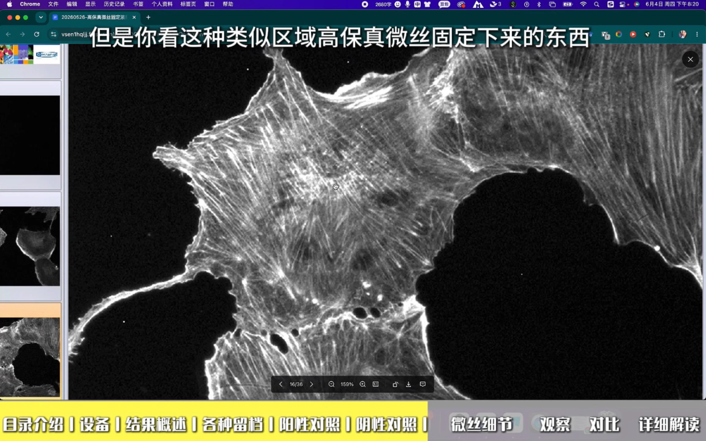 S02 高保真固定液 微丝结构