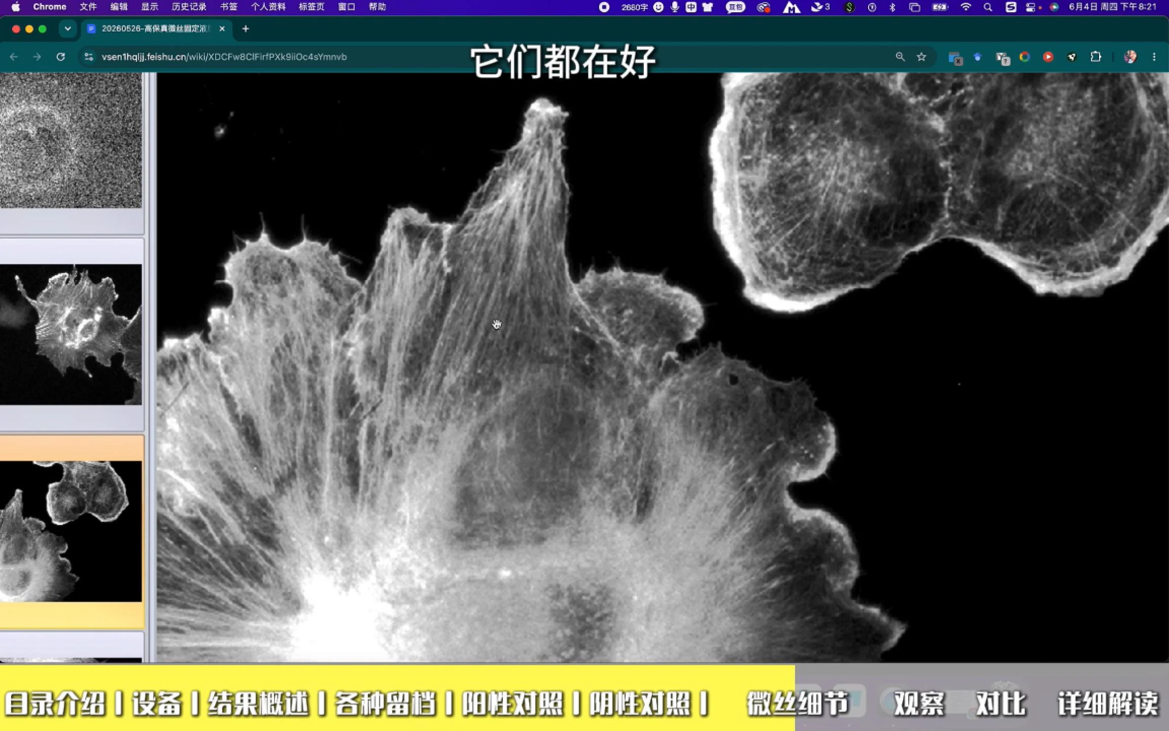 微丝细节细腻分明 1