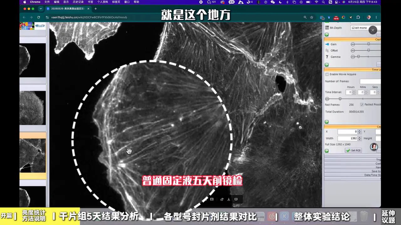 普通固定液 5 天后 1