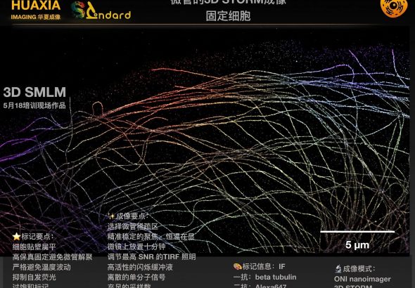 案例05 高保真超分辨级样本-细胞微管的3D STORM成像 参考图