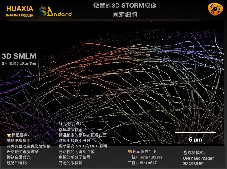 案例05 高保真超分辨级样本-细胞微管的3D STORM成像 参考图
